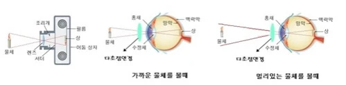 다초점렌즈 가격 알아보시기 전 필독!(누진 렌즈 부작용) 다초점렌즈-원리